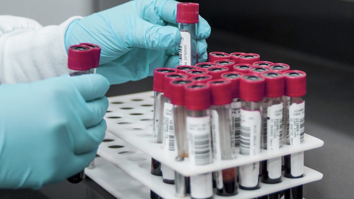 Gloved laboratory technician handling blood sample vials in a tray for lead analysis